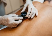 Detectan preocupante incremento de cáncer de piel tras estudio a más de 500 pacientes